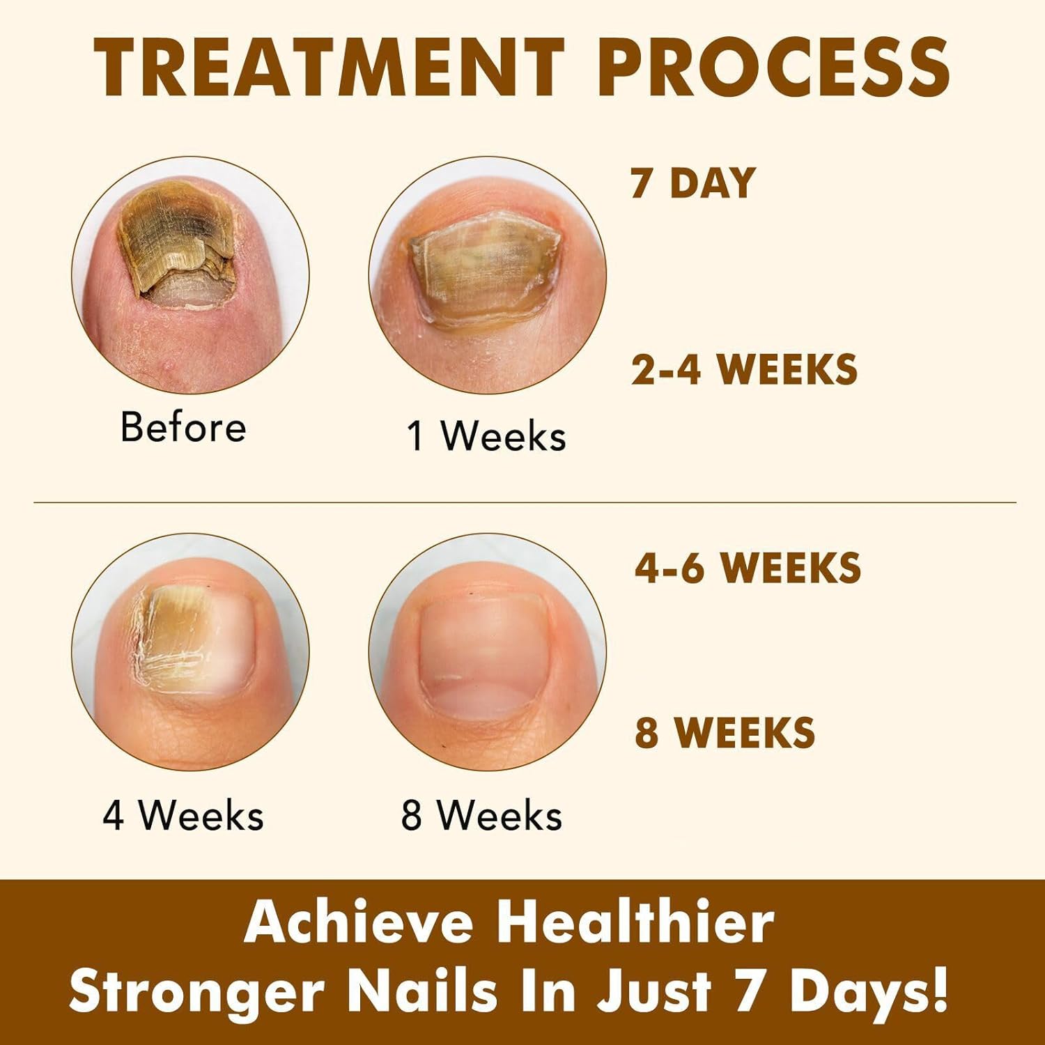 7 Day Ginger Nail Treatment